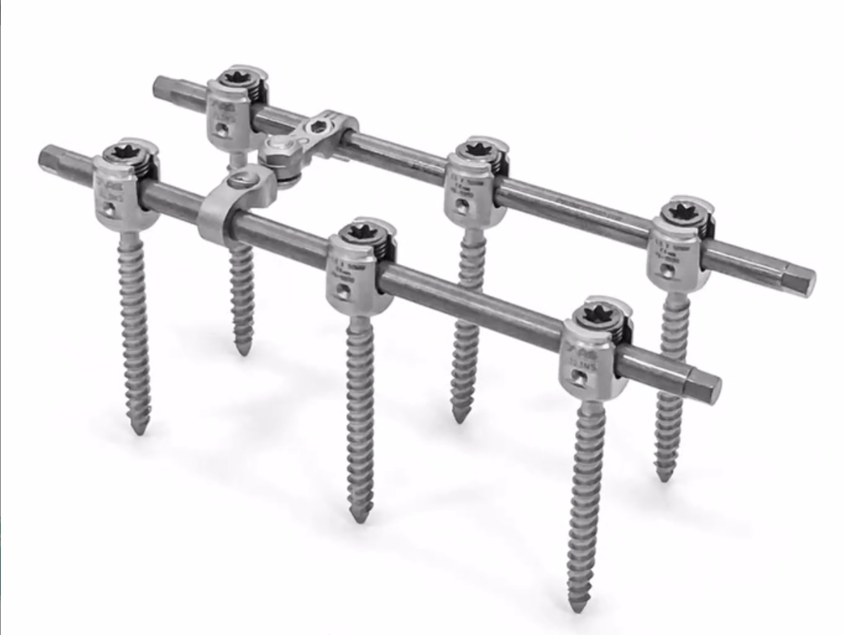 Транспедикулярна конструкція Medical Concept (6 гвинтів)